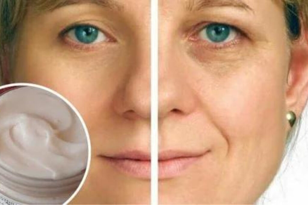 Creme Caseiro para Rugas
