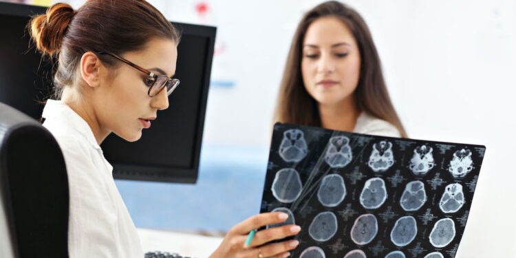 Ataque isquêmico transitório: um sinal de alerta para a saúde cerebral