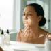 Como Cuidar da Pele com Acne Adulta Após os 30 Anos