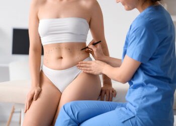 Lipoaspiração a Laser: Entenda o Procedimento, Funcionamento e Recuperação