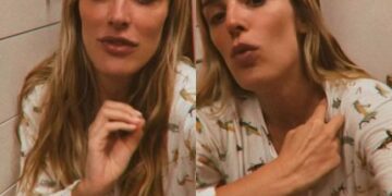 Rafa Brites Responde Críticas sobre Lipedema e Desmistifica Relação entre Magreza e Saúde