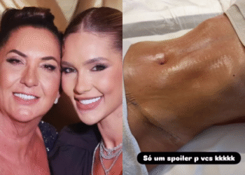 Margareth Serrão Exibe Barriga Chapada Após Cirurgias Plásticas