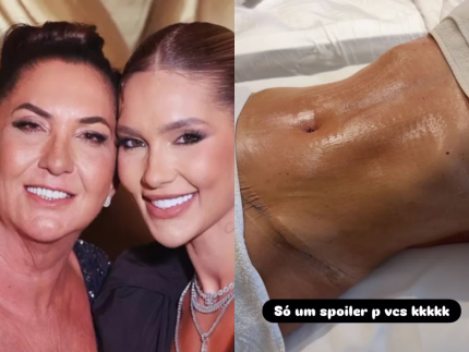 Margareth Serrão Exibe Barriga Chapada Após Cirurgias Plásticas