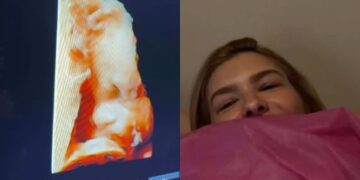 Lore Improta e Léo Santana Fazem Ultrassom e Cantor Brinca com Semelhança com Filho