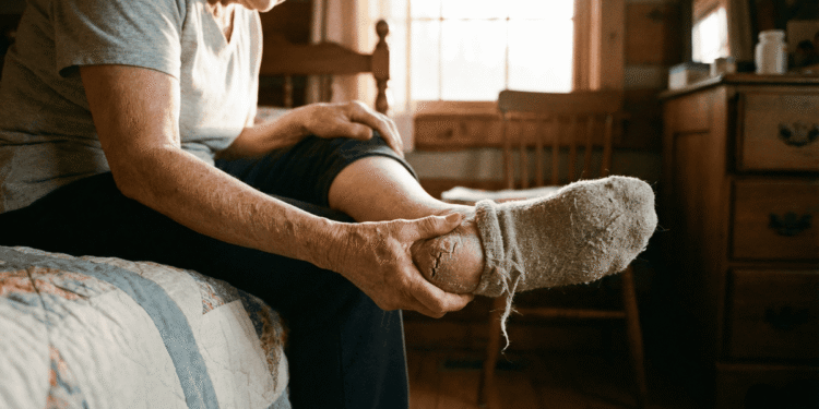 Como Evitar Rachaduras nos Pés e Garantir Conforto ao Calçar Meias