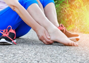 Fascite Plantar: Sintomas, Causas e Tratamentos Eficazes