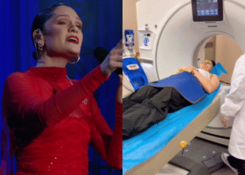 Jessie J sofre acidente em turnê na China e preocupa fãs com desabafo