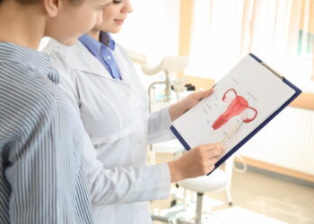 Ovários Multifoliculares: Sintomas, Diagnóstico e Tratamento