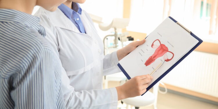 Ovários Multifoliculares: Sintomas, Diagnóstico e Tratamento